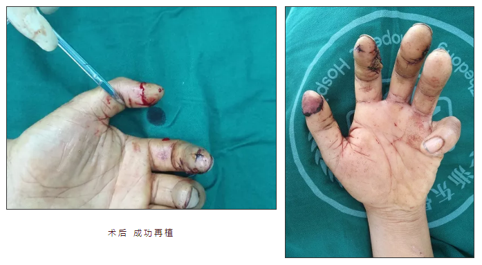 微信截图_20181113143447.png