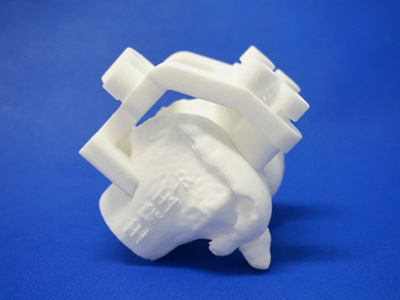 3D打印微创全膝关节置换术