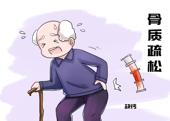 骨骼健康的误区：打破常见的骨骼健康谣言